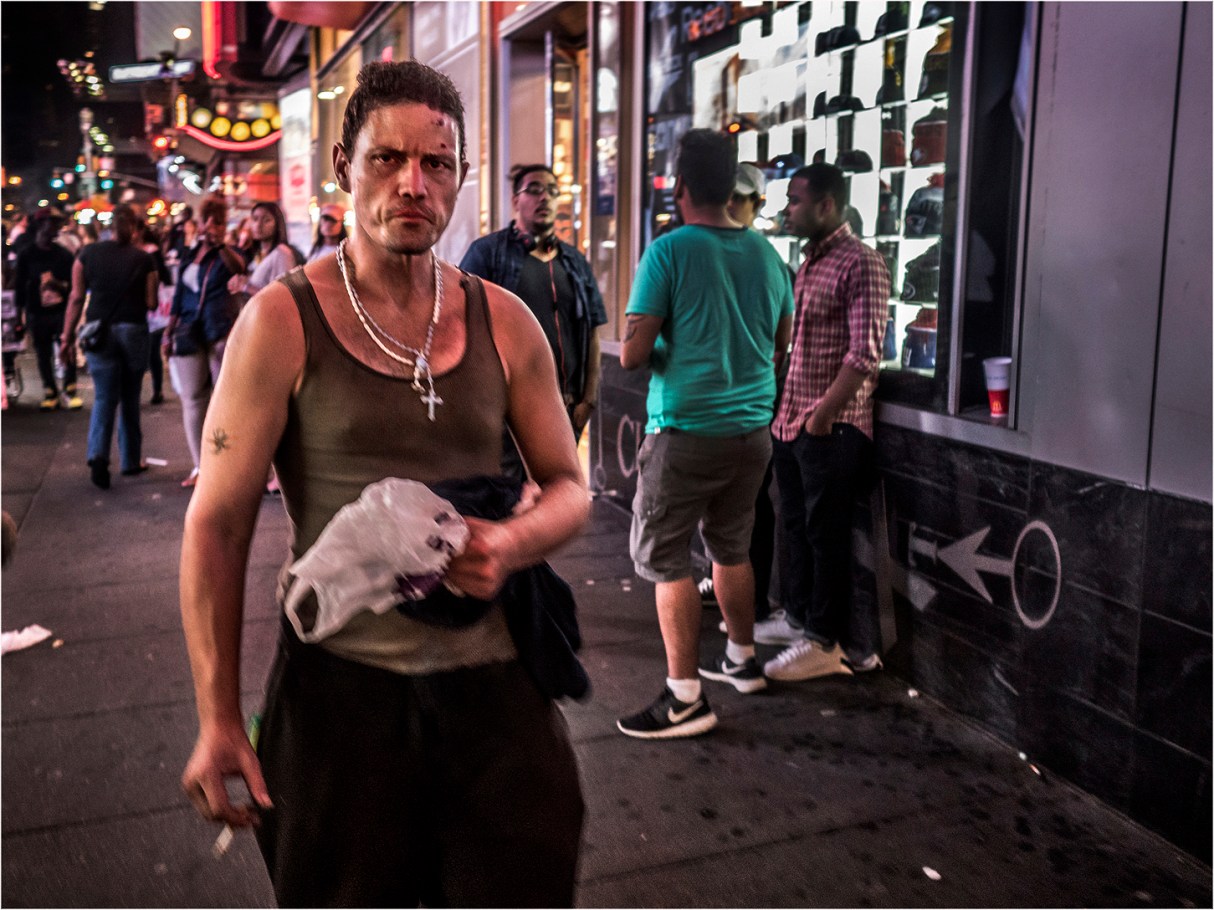 **42-Bruised-Man-Stares copy